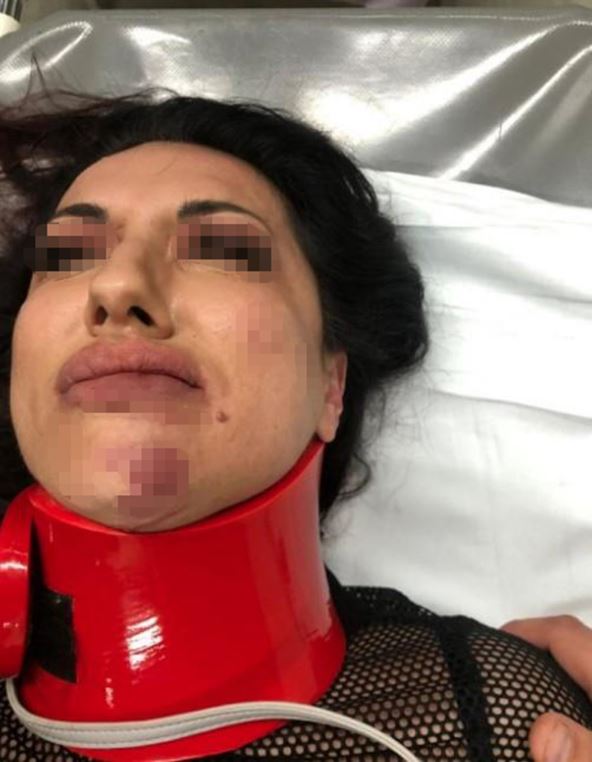 Marina Radosavljević nakon napada.