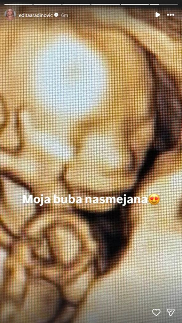 ungk9kpTURBXy81ZGFjNmM4MzAyMTEyZDU0NjVjMWNmZGFmYTE3ZGMxNi5wbmeRkwLNA6wA3gABoTAF.jpg