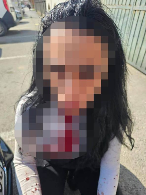 Pretučena žena u Altini u Beogradu