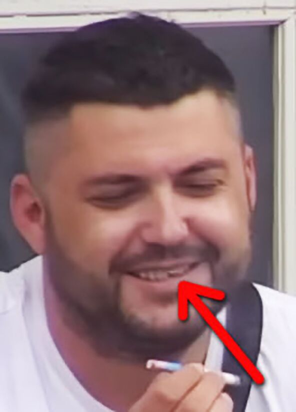 Asmin nakon tuče sa Majom