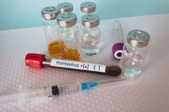 hantavirus