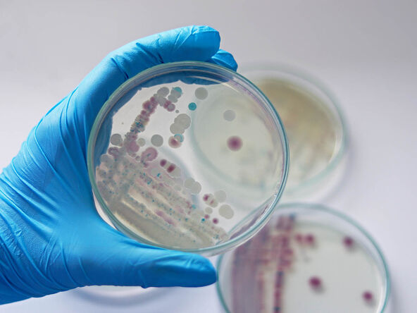 bakterija vibrio vulnificus