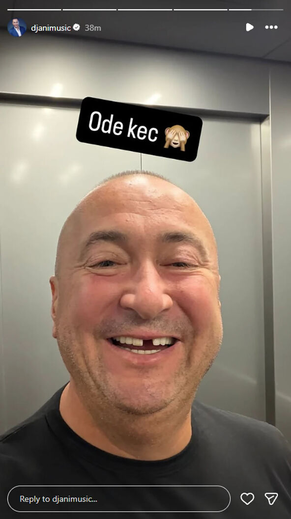 Radiša Trajković Đani bez zuba