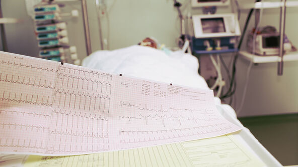 Ekg u bolnici