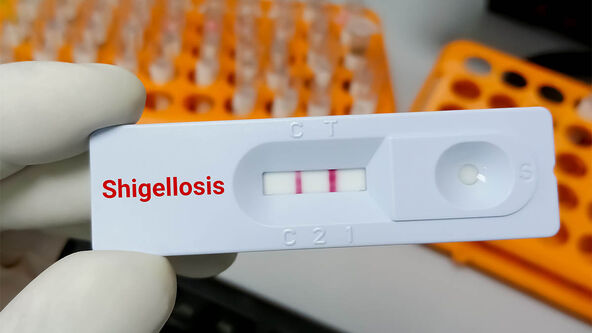 šigeloza