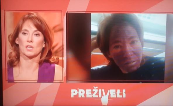 Maja Žeželj imala sepsu bila u komi pokazala kako je izgledala nakon što je dobila sepsu foto  