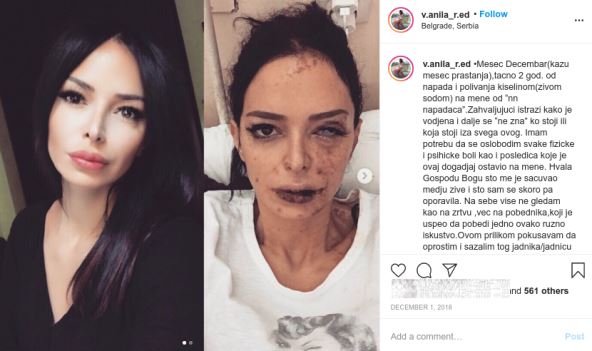 Vladana Radosavljević nakon napada
