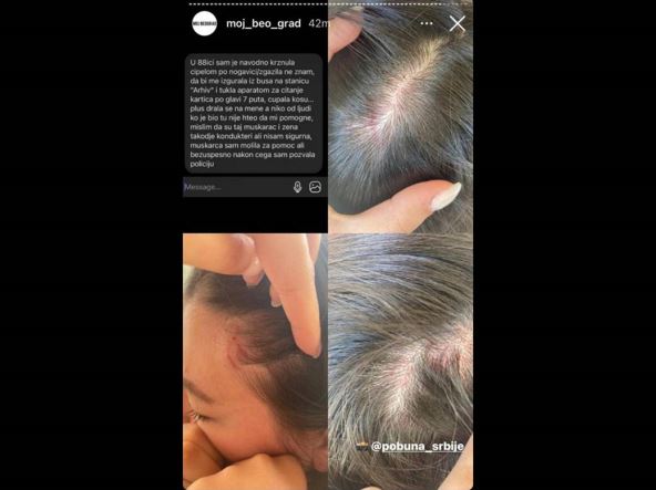 busplus kontrolorka tukla putnicu detalji saopstenje