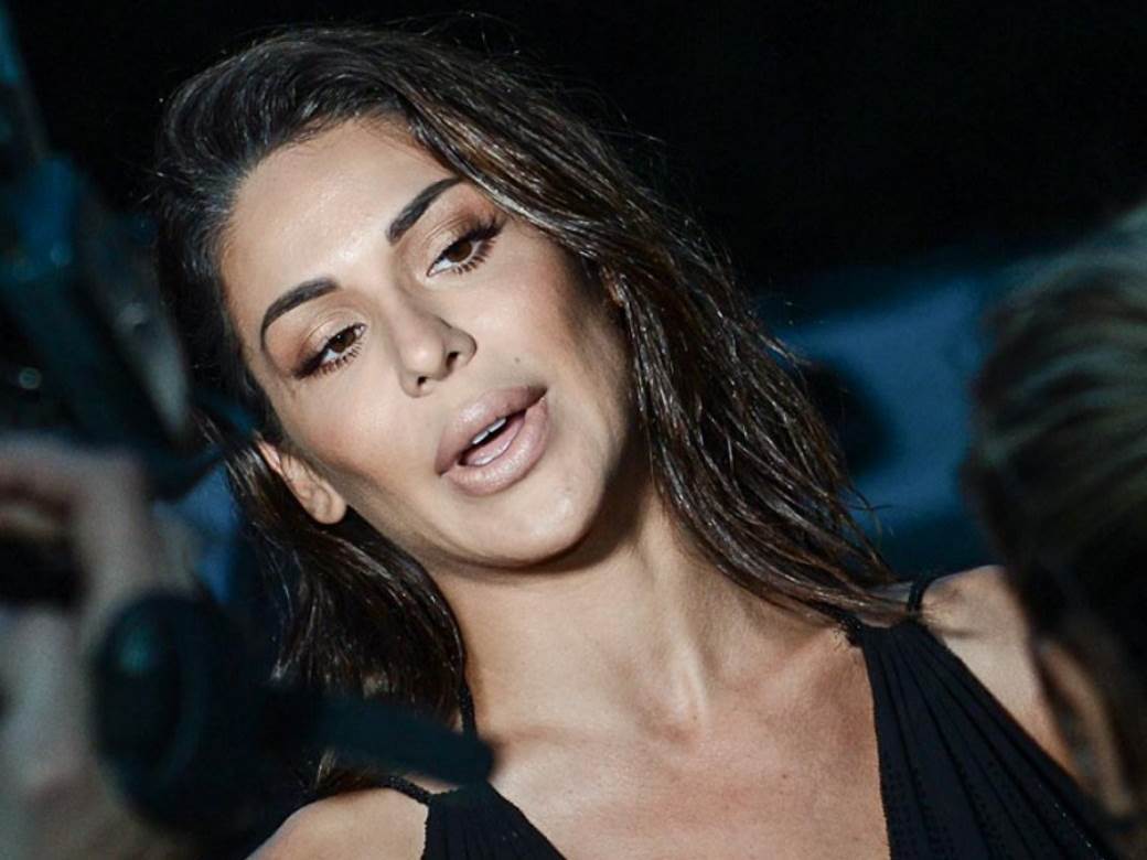 Marina Visković plastične operacije pre i posle