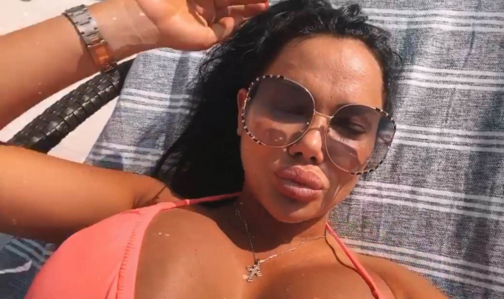 Izgled Tamare Đurić posle novih operacija