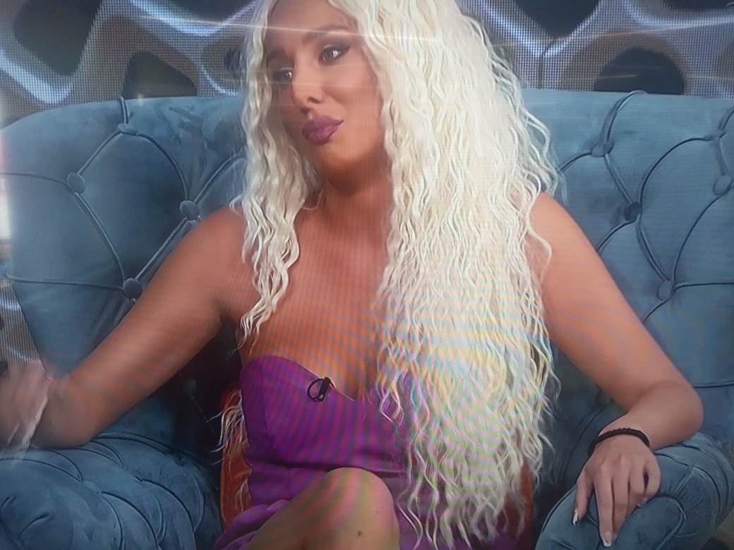 luna djogani plasticne operacije