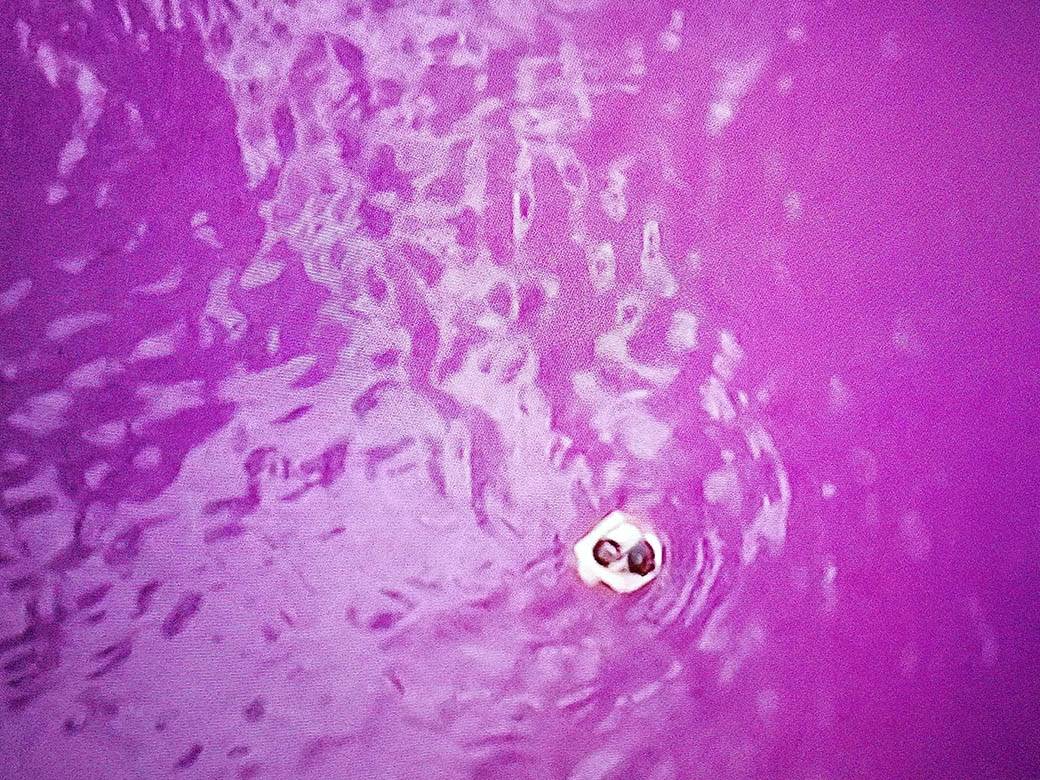 Roze jezero u Bačkoj