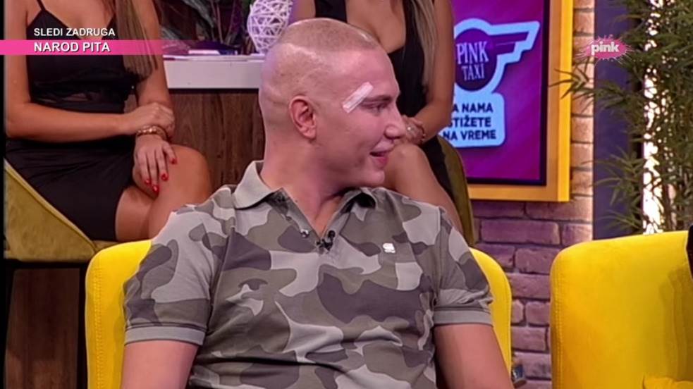 Brendon operacija lica AmiG show