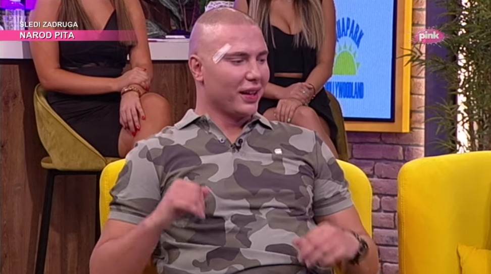 Brendon operacija lica AmiG show