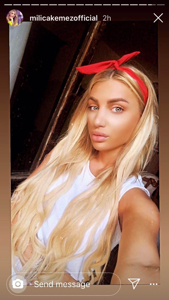 Milica Kemez nos nakon operacije izgled