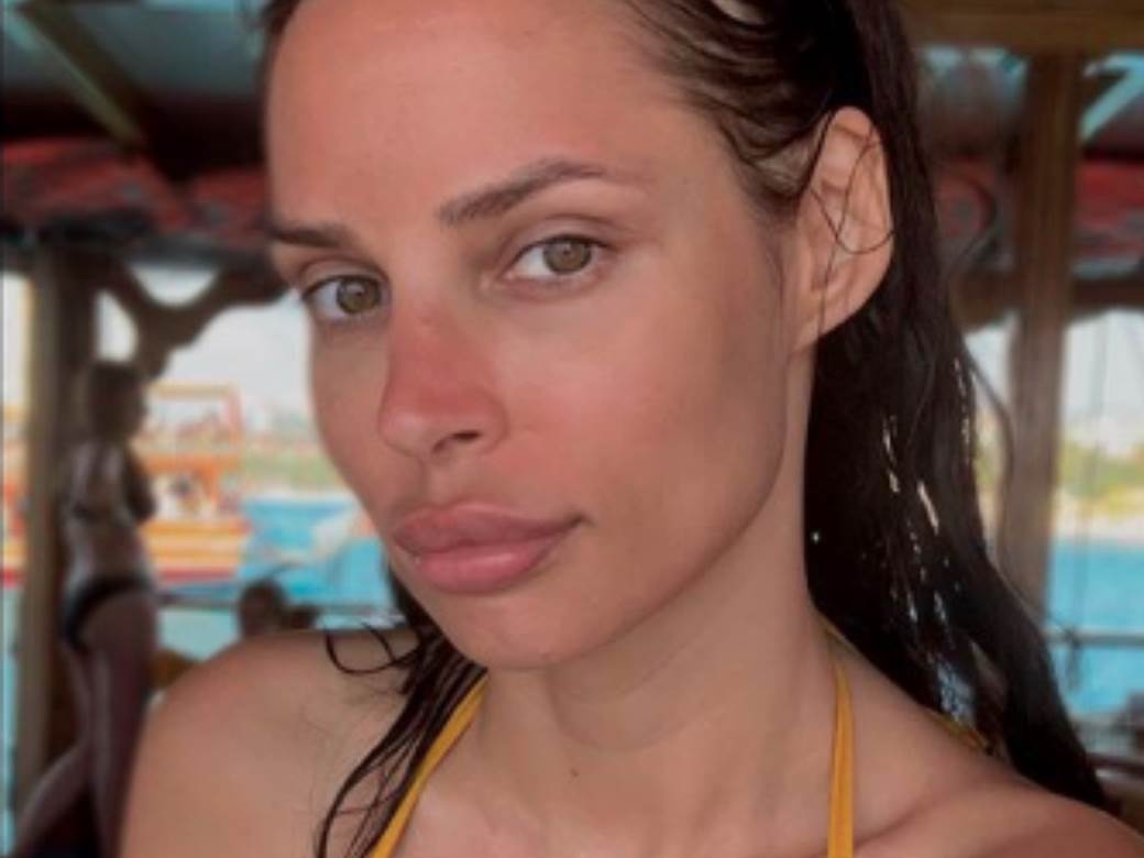 Nataša Šavija pre i posle operacije