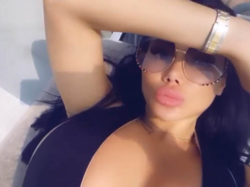 Izgled Tamare Đurić posle novih operacija