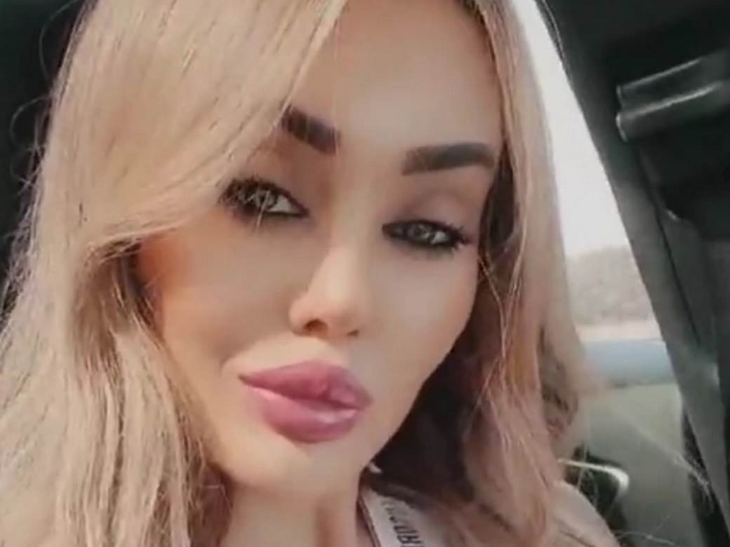 Doktorka o plastičnim korekcijama Cece i Jece