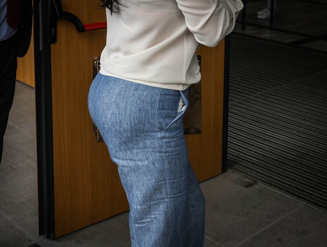 Doktorka o plastičnim korekcijama Cece i Jece