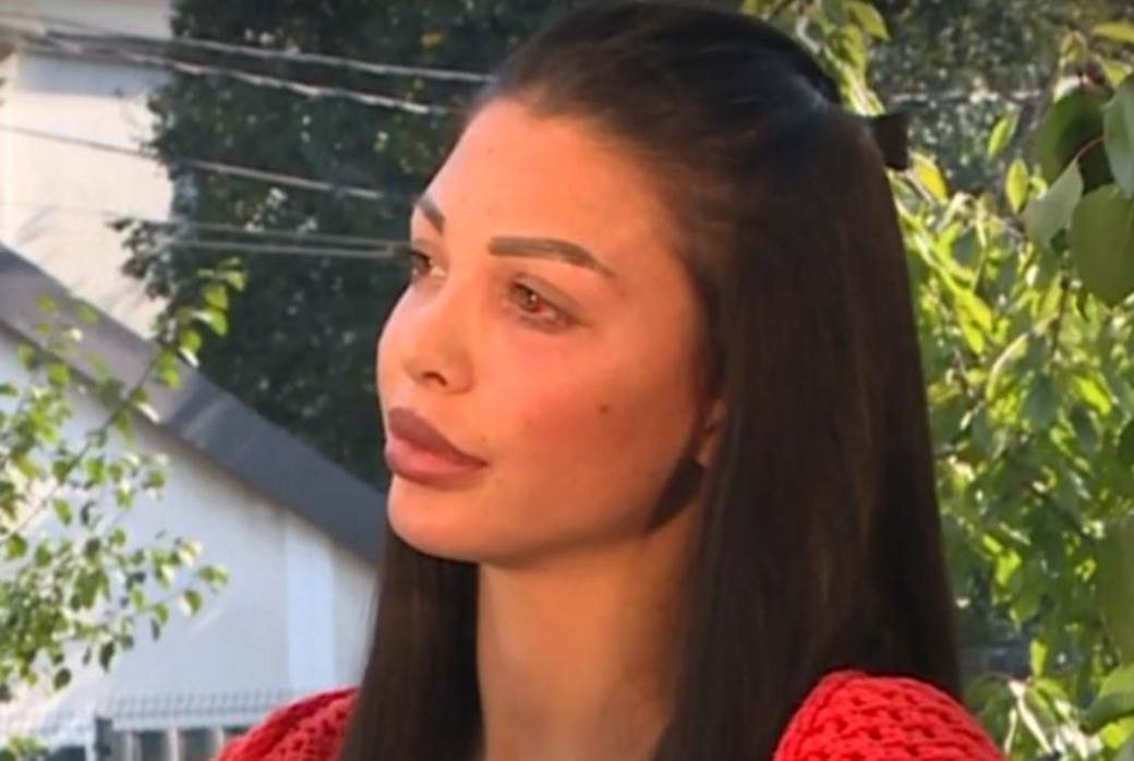 Doktorka o plastičnim korekcijama Cece i Jece