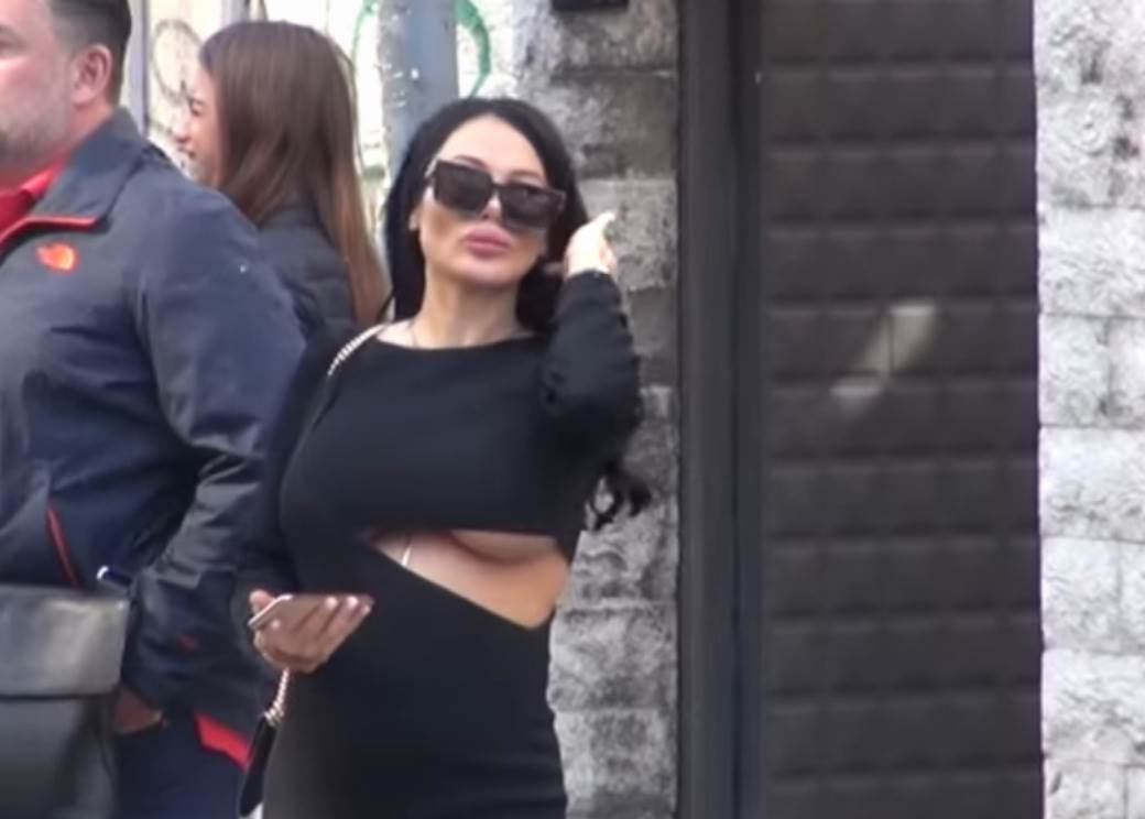 Izgled Tamare Đurić posle novih operacija