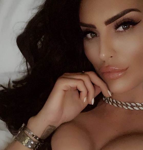 laura braun plasticne operacije pre i posle instagram foto