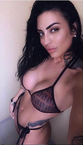 laura braun plasticne operacije pre i posle instagram foto