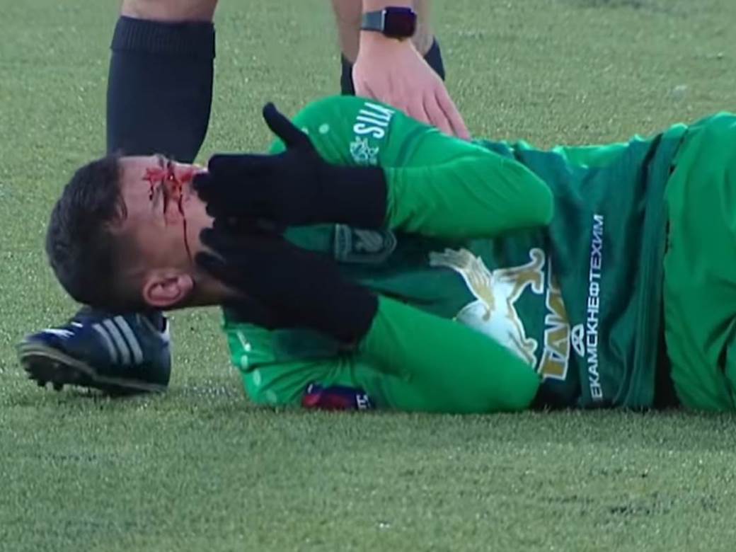 darko jevtic teska povreda rubin rusija potres mozga snimak najnovija vest