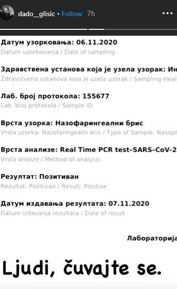dado glisic korona virus borba terapija simtromi