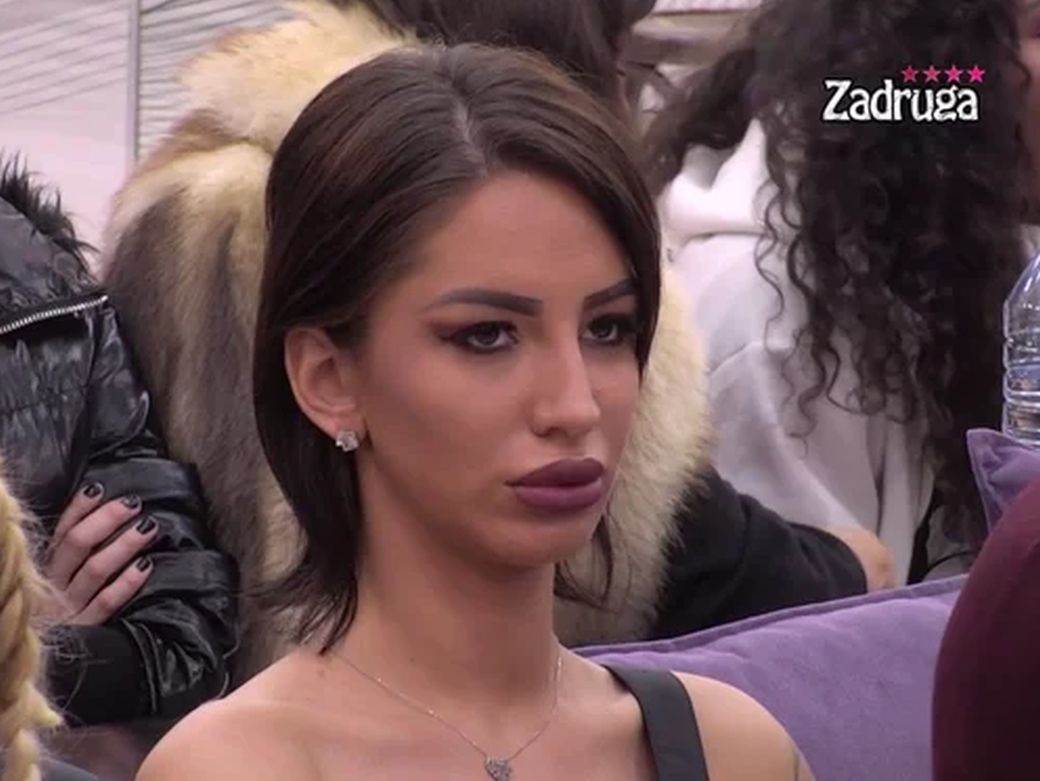 Aleksandra Nikolić pre operacija i danas