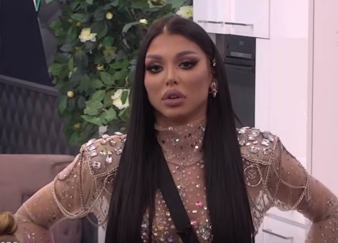 Doktorka o plastičnim korekcijama Cece i Jece