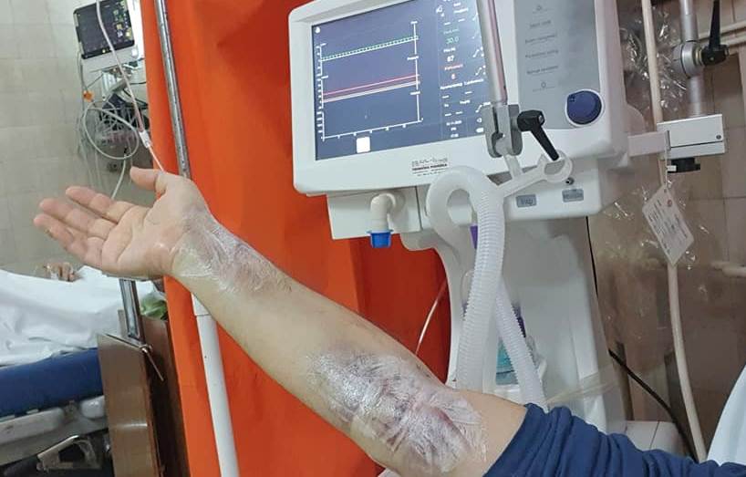 Saša Matejić o borbi sa korona virusom