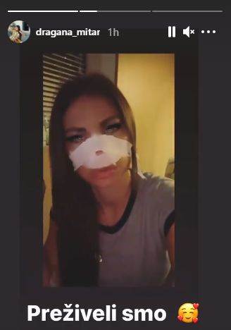 dragana mitar nova operacija plasticne operacije operisala nos