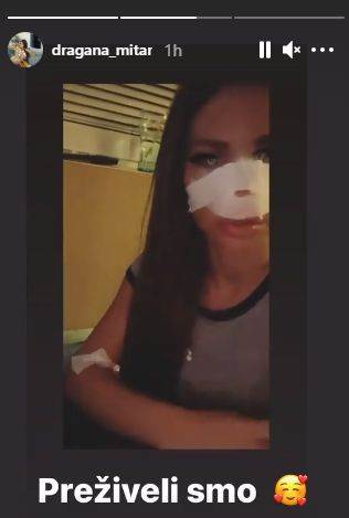 dragana mitar nova operacija plasticne operacije operisala nos