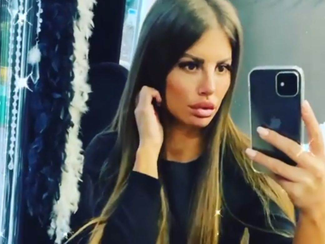 dragana mitar operacija nosa instagram foto video