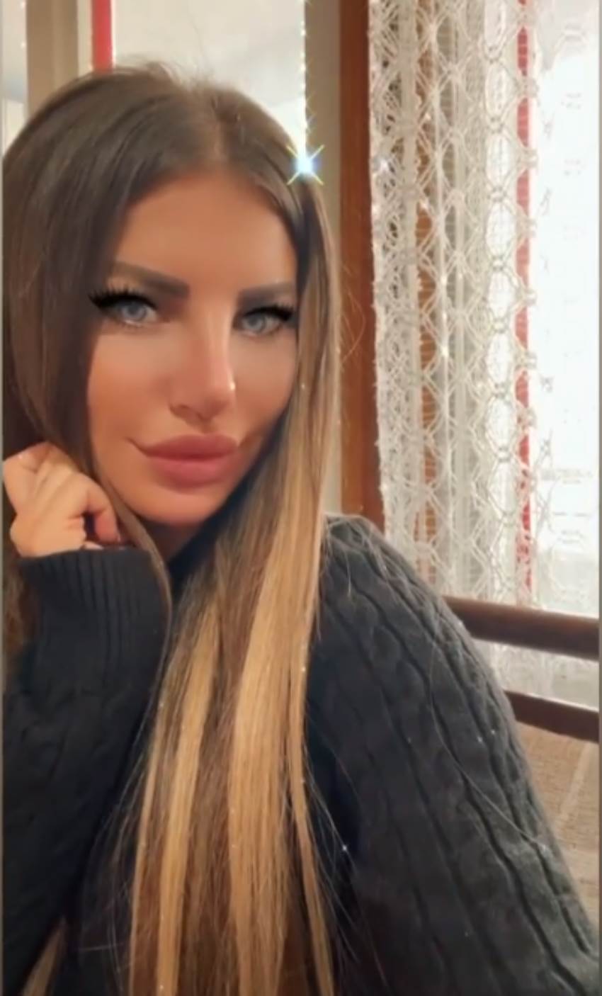 dragana mitar operacija nosa instagram foto video