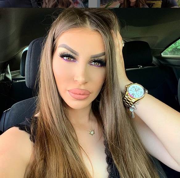 Dalila Dragojević pre plastičnih operacija