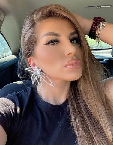 Dalila Dragojević pre plastičnih operacija