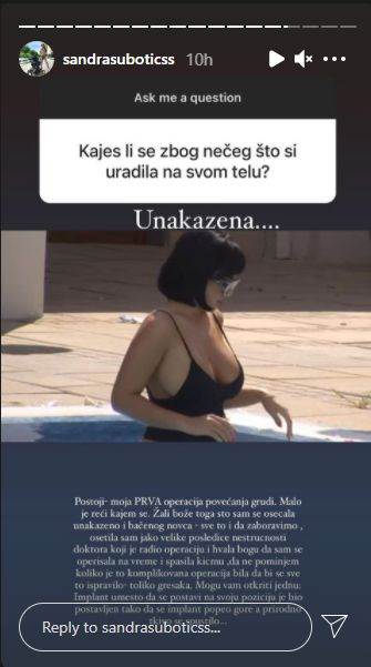 aleksandra subotic operacije estetski zahvati