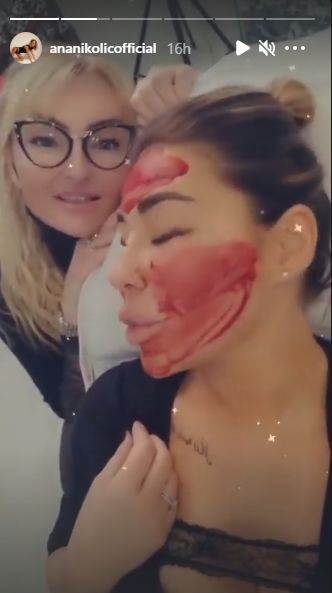 ana nikolic objava krvavo lice tretman