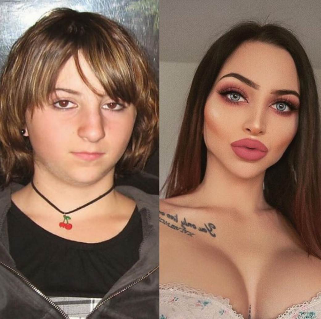 selin sentino plasticne operacije pre i posle foto