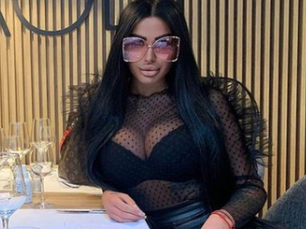 tijana ajfon plasticne operacije botoks video