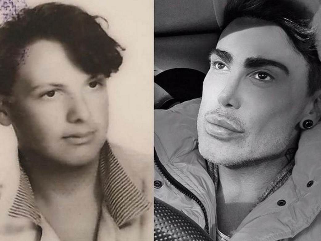 neven ciganovic pre operacija