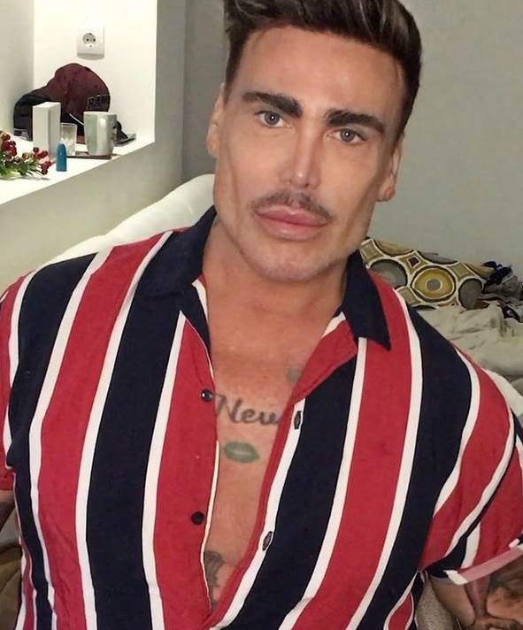 neven ciganovic pre operacija