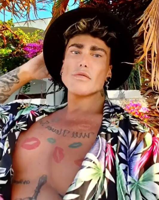 neven ciganovic pre operacija