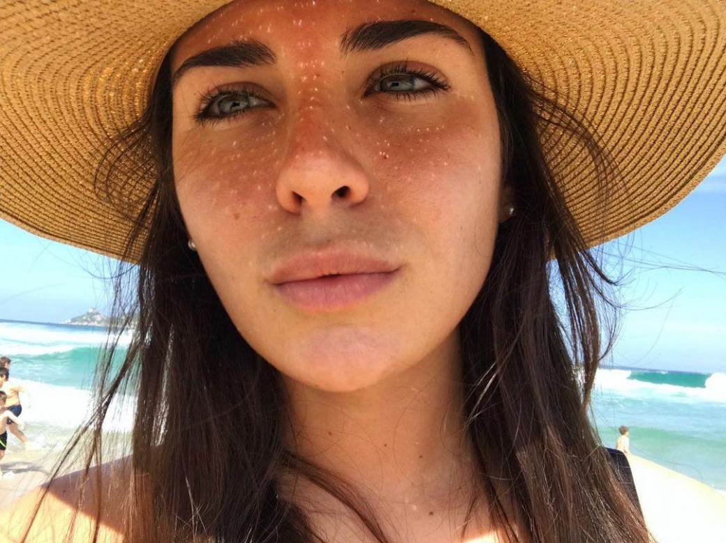 Krv na dresu Reala posle meča sa Atletikom