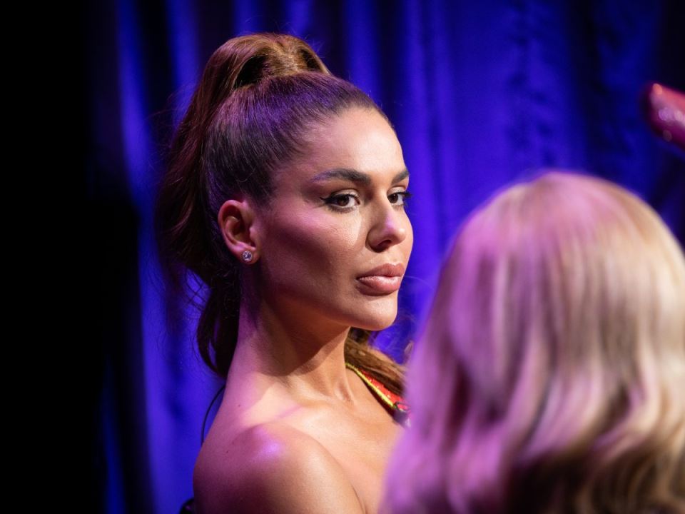 Marina Visković plastične operacije pre i posle