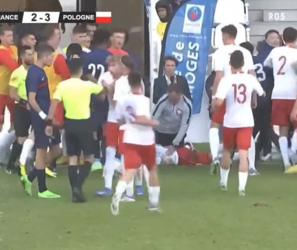 Francuska Poljska povreda  (6).jpg
