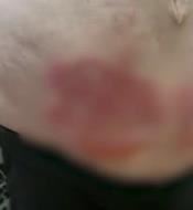 Rane na stomaku Leposave Bajković