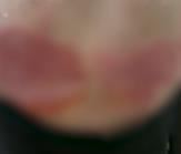 Rane na stomaku Leposave Bajković